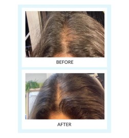 Hår Force Serum & Booster LED Kit - Talika